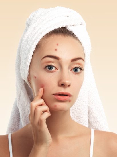 Best Skincare Routine for Acne