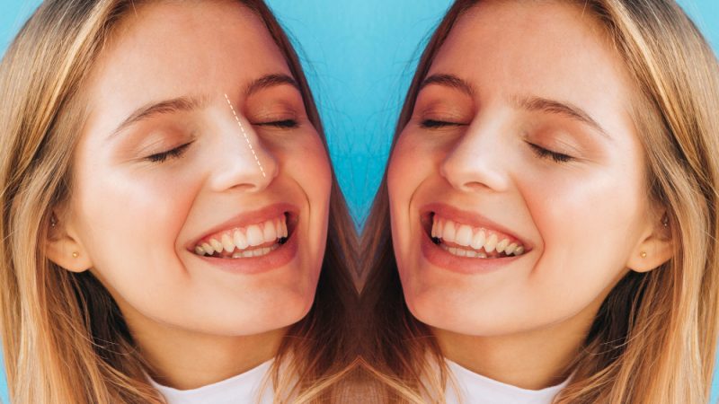 Teeth Bleaching Before and After