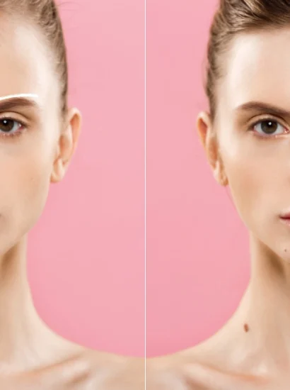 How to Fix an Asymmetrical Face