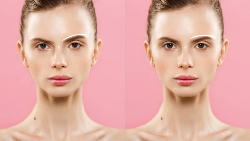 How to Fix an Asymmetrical Face