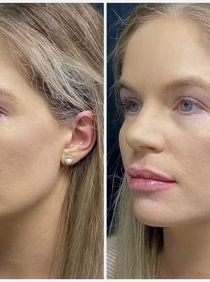 Facial Harmony