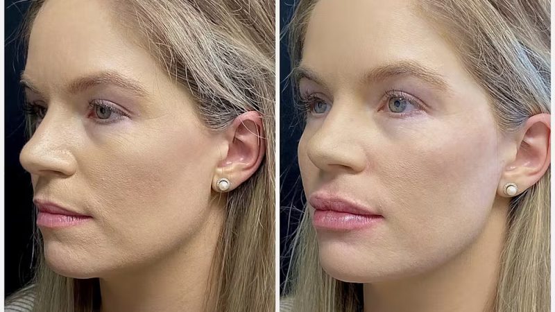 Facial Harmony