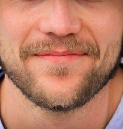 Square Jaw