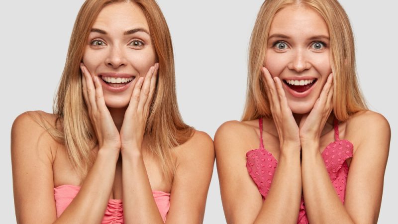 Teeth Whitening Before and After