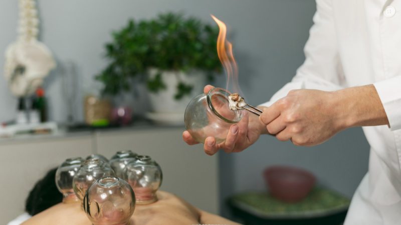 Cupping for Fat Loss