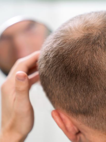 Hairline Embroidery