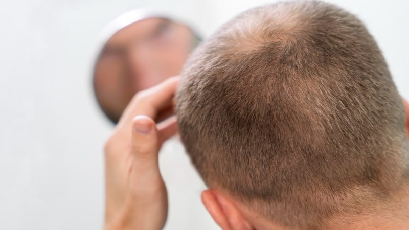 Hairline Embroidery