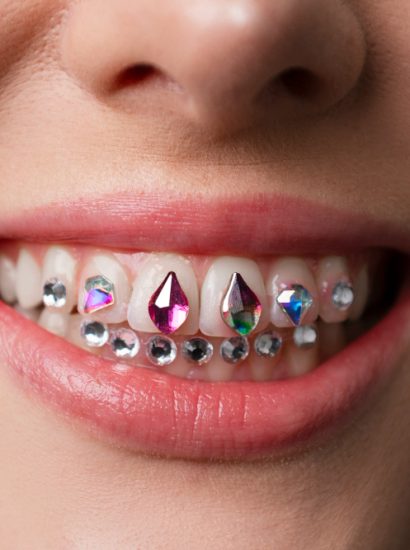 Tooth Crystals