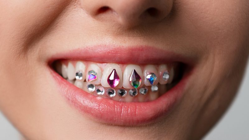 Tooth Crystals