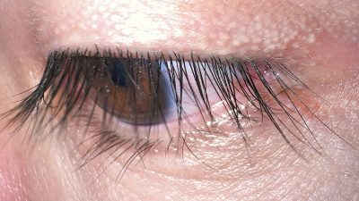 What Are Eyelashes Made Of? Structure, Function & Facts Explained