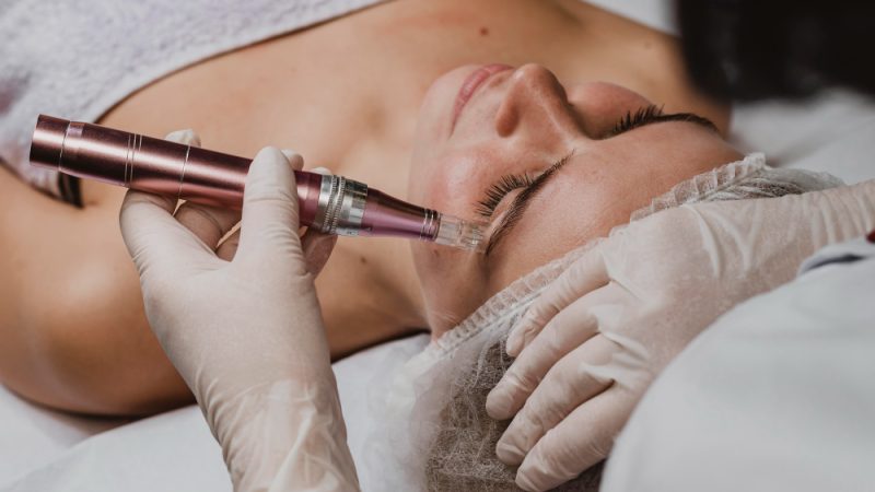 Microneedle Skincare