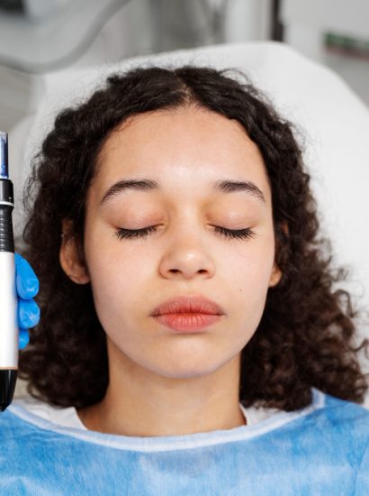 Microneedling for Scars