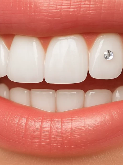 how much is a tooth gem