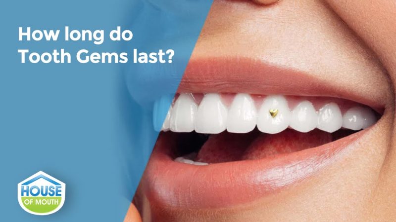 Tooth Gems That Actually Stay